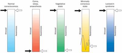 The Potential Role of fNIRS in Evaluating Levels of Consciousness